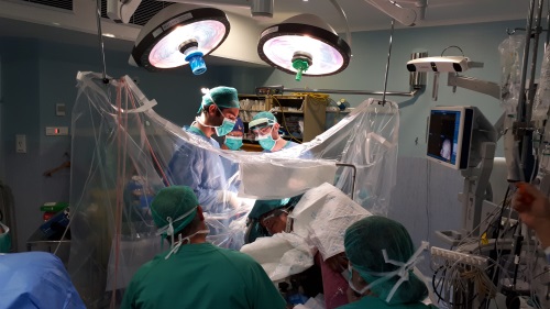 Fotografia 3 durant la intervenció de cirurgia de mapatge cerebral