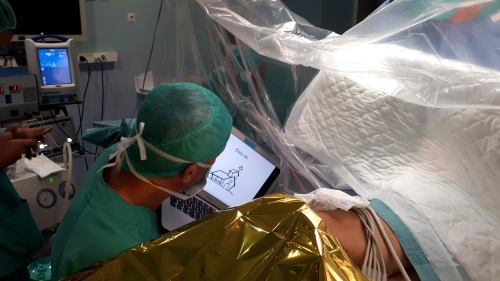 Fotografia 1 durant la intervenció de cirurgia de mapatge cerebral