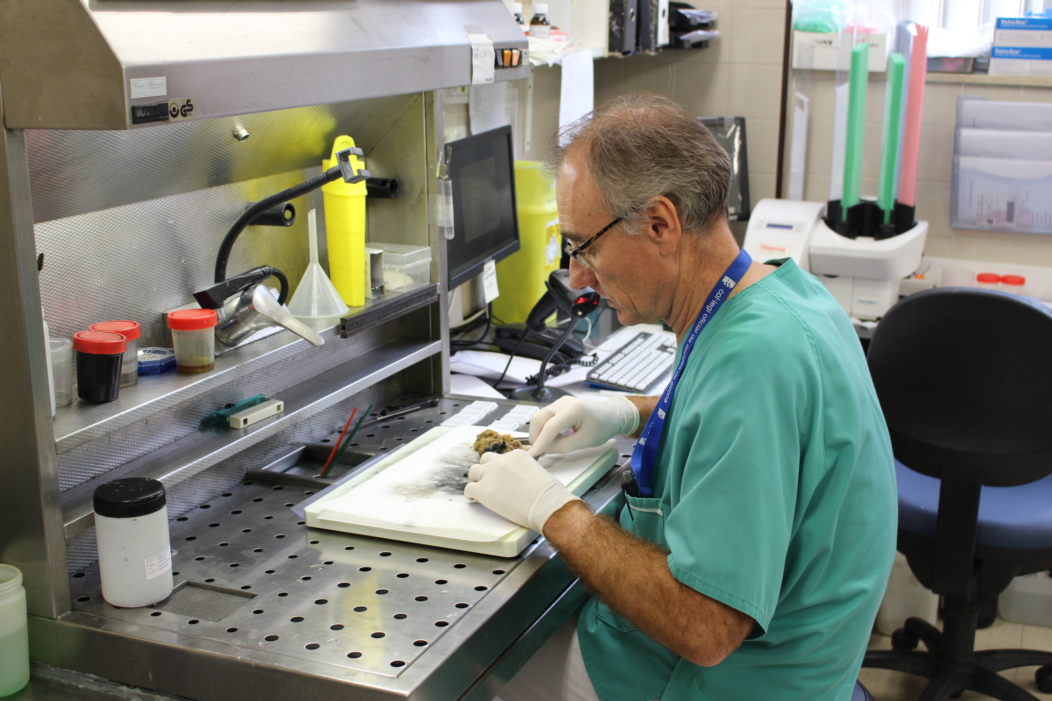 El Dr. López Bonet, cap de Servei d?Anatomia Patològia, analitzant una peça de teixit