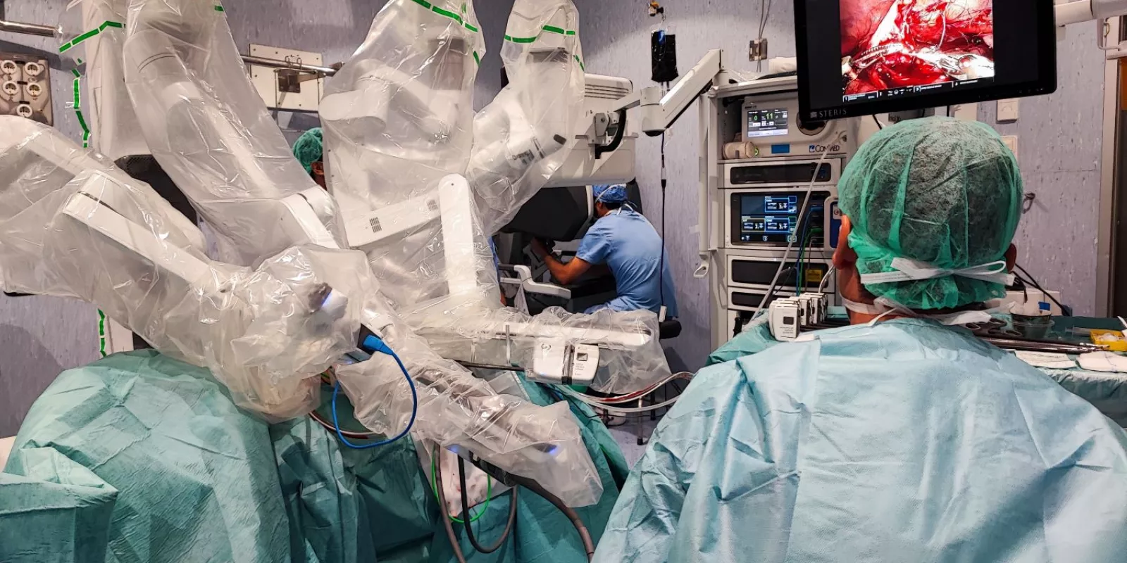 Operació de cirurgia robòtic pediàtrica realitzada a l'Hospital Trueta