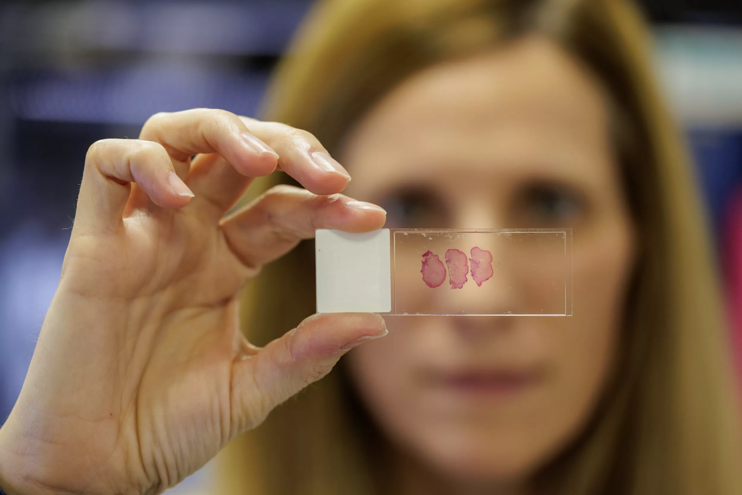 Médico de Anatomía patológica enseñando una muestra de sangre preparada para microscopio