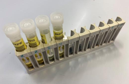 imatge de recurs de tubs d'assaig amb proves d'orina