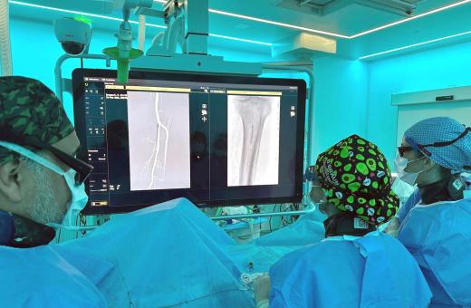 Profesisonals del Sevei d'Angiologia i Cirurgia Vascular del Trueta durant la intervenció d'implant del ispositiu reabsorbible en artèries distals de la cama per sota del genoll.
