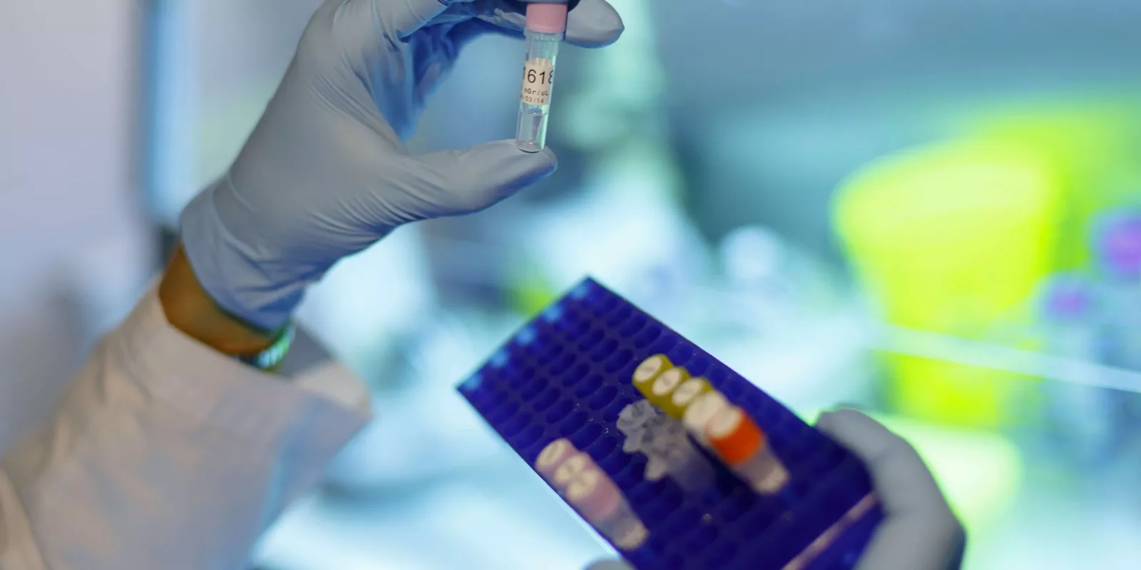 Manos con guantes mostrando muestras de sangre