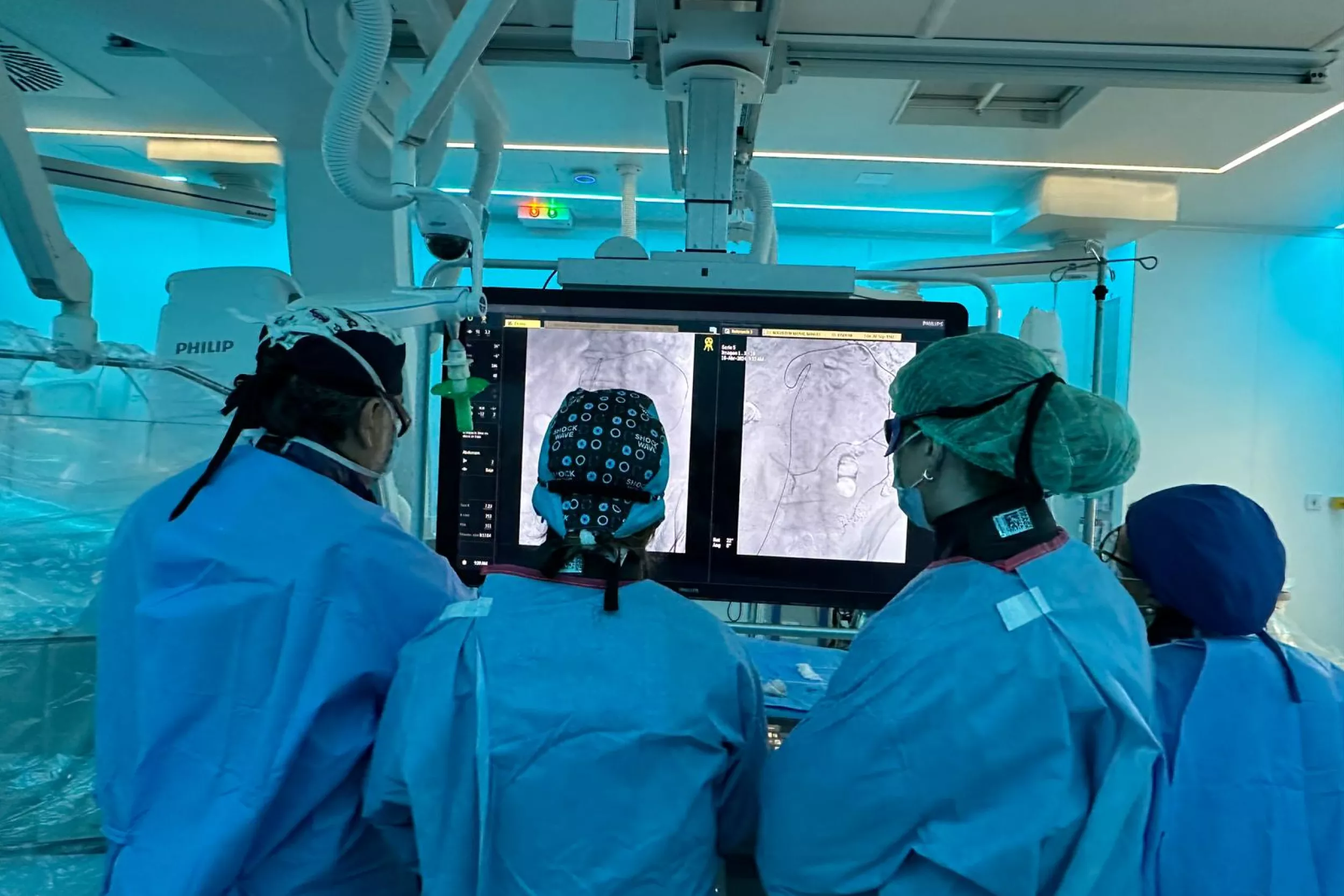 Metges en un quiròfan observant una pantalla amb vasos sanguinis i el sistema limfàtic.