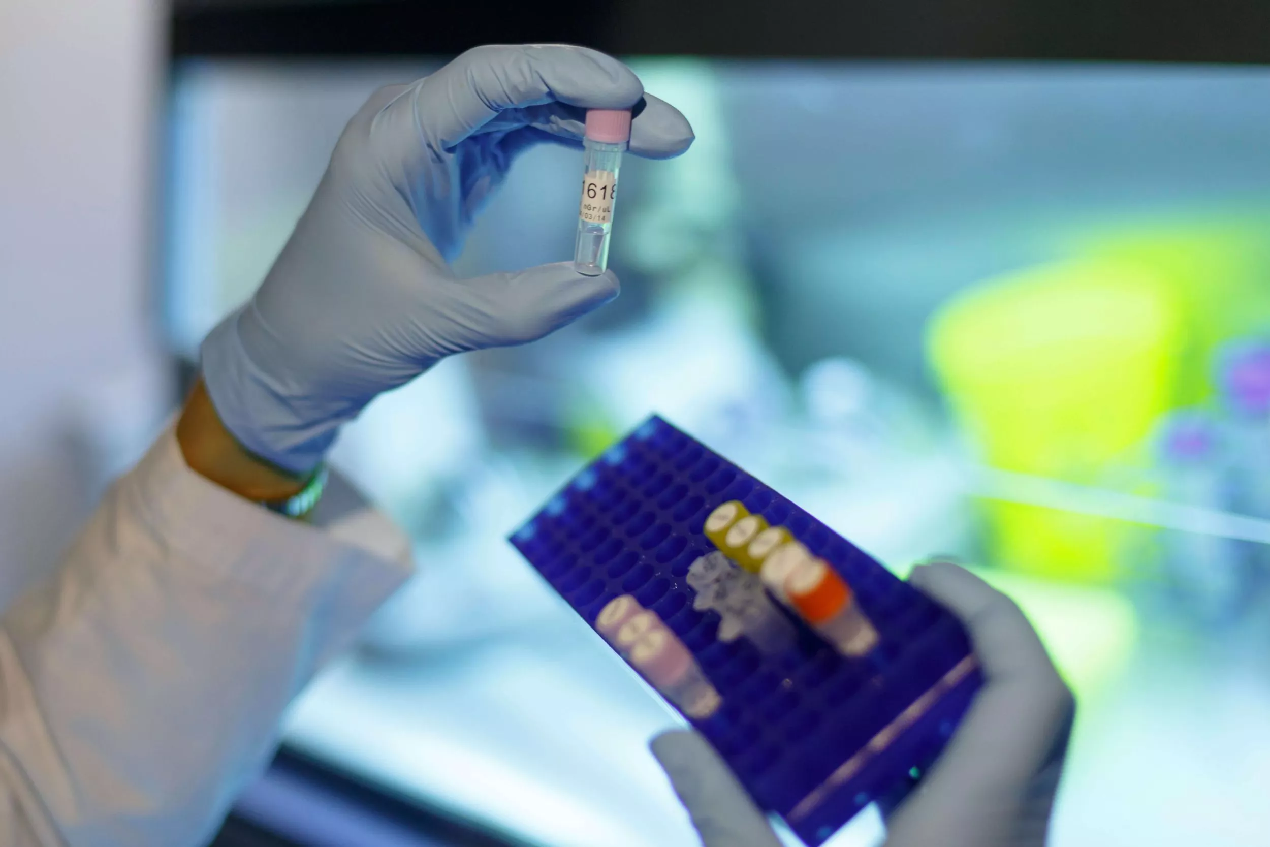 Mans d'un metge manipulant tubs de mostres de pacients