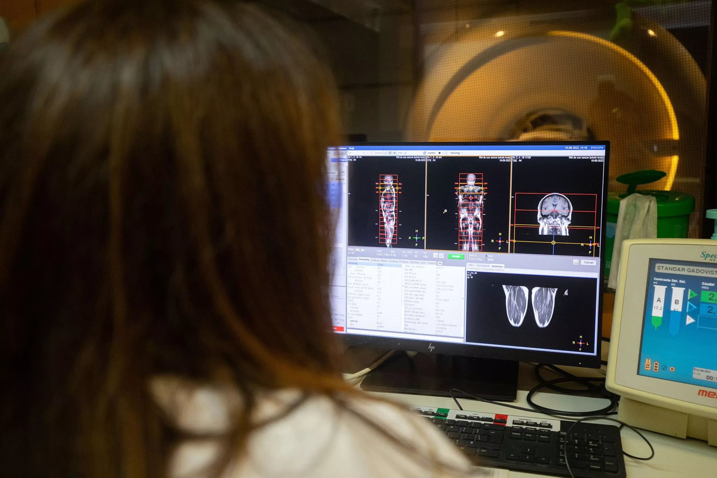 Metge de radiologia veient els resultats d'unes proves de radiodiagnosi