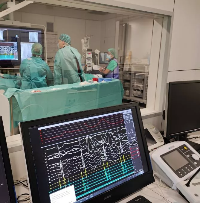 Imatges d'una intervenció per a tractar un cas de fibril·lació auricular utilitzant el procediment d'electroporació realizada a la sala d’electrofisiologia cardíaca ubicada a la Unitat d'Arrítmies del centre.    