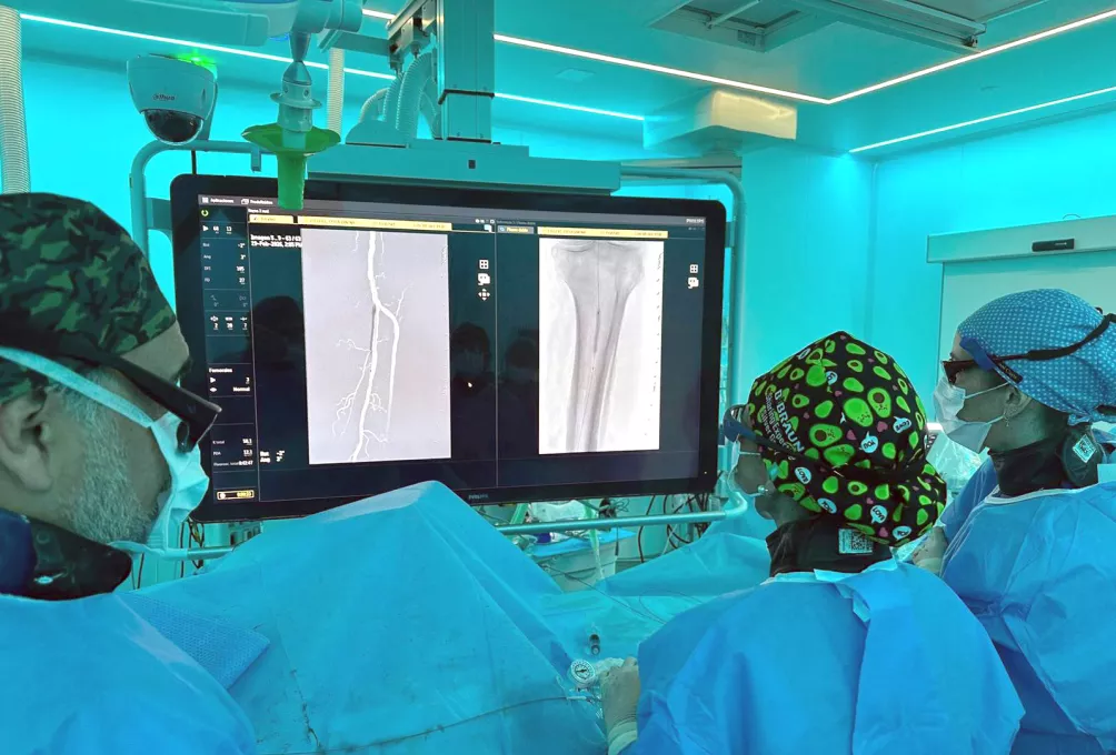 Profesisonals del Sevei d'Angiologia i Cirurgia Vascular del Trueta durant la intervenció d'implant del ispositiu reabsorbible en artèries distals de la cama per sota del genoll.