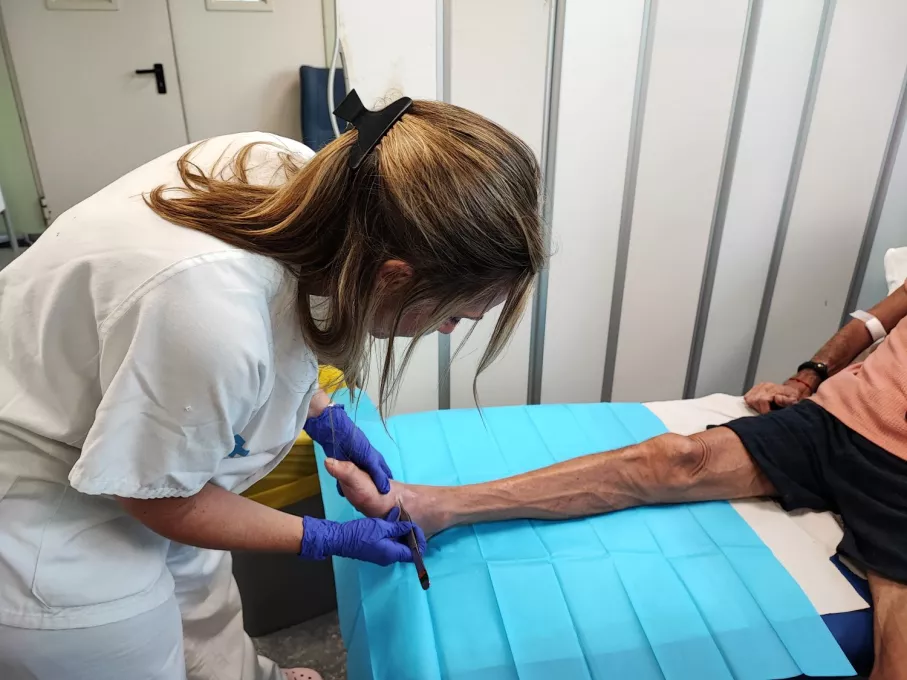 Professional del Trueta fa cures vinculades al peu diabètic a l'Hospital de Dia del Trueta