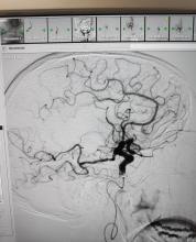 Imatge d'un estudi de neurologia.